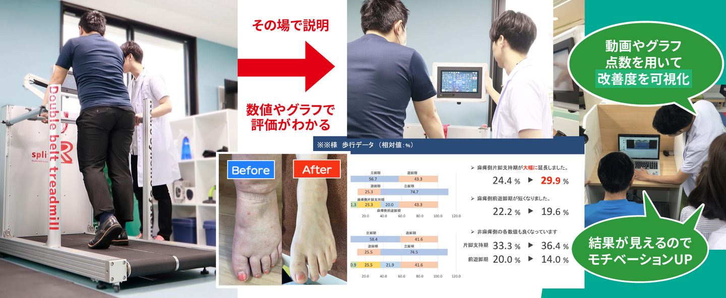 リハビリ改善度解説
